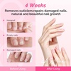 image:imageMelodySusie 6Pcs Nail Files 100180 Grit Double Sided Emery Boards Set for Acrylic Gel and Natural Nails Professional Manicure Pedicure Shaping Tools for Home Salon Care PinkMultiple Colors