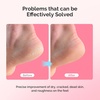 image:imageMelodySusie Moisturizing Heel Socks for Cracked Heel TreatmentUniversal StyleSuitable for Home and Salon UseSize RegularGray and Blue2 Pairspink and gray