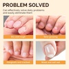 image:imageMelodySusie 10ML Cuticle Care Kit  Cuticle Oil and Cuticle Remover Cuticle Nourishes and Softener Promotes Nail Growth and Strength for Home and Salon Use 2PCS0 Fl Oz Pack of 6